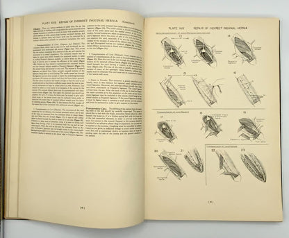 Ah/ Atlas of Surgical Operations by Elliott C. Cutler 1939